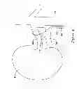 Fig. 05 - RENAL NERVE MODULATION DEVICES AND METHODS FOR RENAL NERVE MODULATION