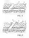 Fig. 02 - Vascular sealing device and method using clot enhancing balloon and electric field generation