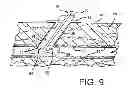 Fig. 06 - Vascular sealing device and method using clot enhancing balloon and electric field generation