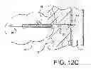 Fig. 09 - Vascular sealing device and method using clot enhancing balloon and electric field generation
