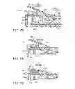 Fig. 16 - Treatment instrument system with thermally deformable absorbent member and slidable holding surface