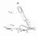 Fig. 02 - Fixation system, an intramedullary fixation assembly and method of use