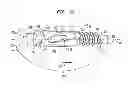 Fig. 04 - Fixation system, an intramedullary fixation assembly and method of use