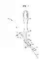 Fig. 06 - Fixation system, an intramedullary fixation assembly and method of use