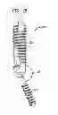 Fig. 18 - Fixation system, an intramedullary fixation assembly and method of use