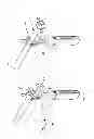 Fig. 08 - Suprapatellar insertion system, kit and method
