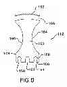 Fig. 08 - Surgical sagittal saw capable of actuating a blade assembly that includes a static bar and a drive rod