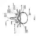 Fig. 02 - DEVICES, SYSTEMS AND METHODS FOR TISSUE MODIFICATION