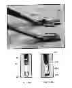 Fig. 08 - DEVICES, SYSTEMS AND METHODS FOR TISSUE MODIFICATION