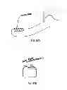 Fig. 33 - DEVICES, SYSTEMS AND METHODS FOR TISSUE MODIFICATION