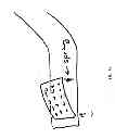 Fig. 41 - DEVICES, SYSTEMS AND METHODS FOR TISSUE MODIFICATION