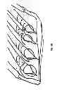 Fig. 45 - DEVICES, SYSTEMS AND METHODS FOR TISSUE MODIFICATION