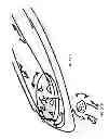 Fig. 46 - DEVICES, SYSTEMS AND METHODS FOR TISSUE MODIFICATION