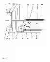 Fig. 04 - Dispensing device for bone cement
