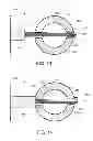 Fig. 09 - Round depth gauge