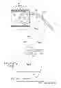 Fig. 03 - TOOL FOR INSERTING FINE TUBULAR OBJECTS INTO THE COCHLEA