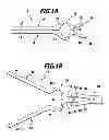 Fig. 02 - Surgical clip