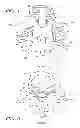 Fig. 02 - Radially adjustable tissue removal device