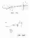 Fig. 09 - Radially adjustable tissue removal device