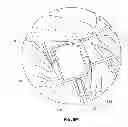 Fig. 33 - Anatomical location markers and methods of use in positioning sheet-like materials during surgery