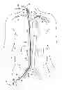 Fig. 01 - Transvascular retrograde access devices