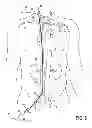 Fig. 06 - Transvascular retrograde access devices