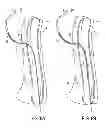 Fig. 07 - Transvascular retrograde access devices