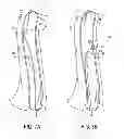 Fig. 09 - Transvascular retrograde access devices