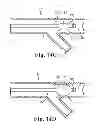 Fig. 09 - Hemostasis valve and guidewire pacing system
