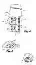 Fig. 04 - Surgical fastening assembly