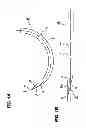 Fig. 02 - Medical Suture Needle