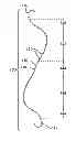 Fig. 01 - METHODS AND DEVICES FOR SOFT PALATE TISSUE ELEVATION PROCEDURES