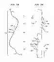 Fig. 02 - METHODS AND DEVICES FOR SOFT PALATE TISSUE ELEVATION PROCEDURES