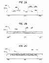 Fig. 03 - METHODS AND DEVICES FOR SOFT PALATE TISSUE ELEVATION PROCEDURES