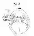 Fig. 04 - METHODS AND DEVICES FOR SOFT PALATE TISSUE ELEVATION PROCEDURES