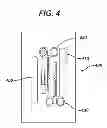 Fig. 06 - METHODS AND DEVICES FOR SOFT PALATE TISSUE ELEVATION PROCEDURES