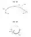 Fig. 07 - METHODS AND DEVICES FOR SOFT PALATE TISSUE ELEVATION PROCEDURES