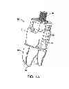 Fig. 02 - Interspinous spacer
