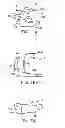 Fig. 15 - Interspinous spacer