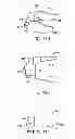 Fig. 16 - Interspinous spacer