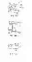 Fig. 19 - Interspinous spacer