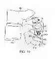 Fig. 26 - Interspinous spacer