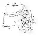 Fig. 01 - Interspinous spacer