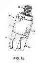 Fig. 02 - Interspinous spacer