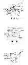 Fig. 07 - Interspinous spacer