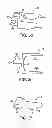 Fig. 08 - Interspinous spacer