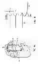 Fig. 09 - Interspinous spacer