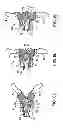 Fig. 11 - Interspinous spacer