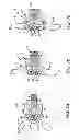 Fig. 12 - Interspinous spacer