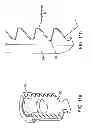 Fig. 19 - Interspinous spacer